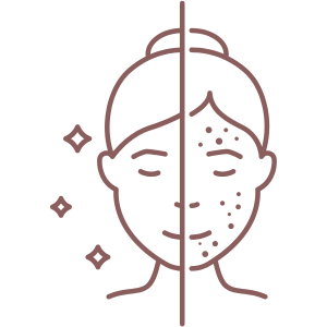 Microneedling