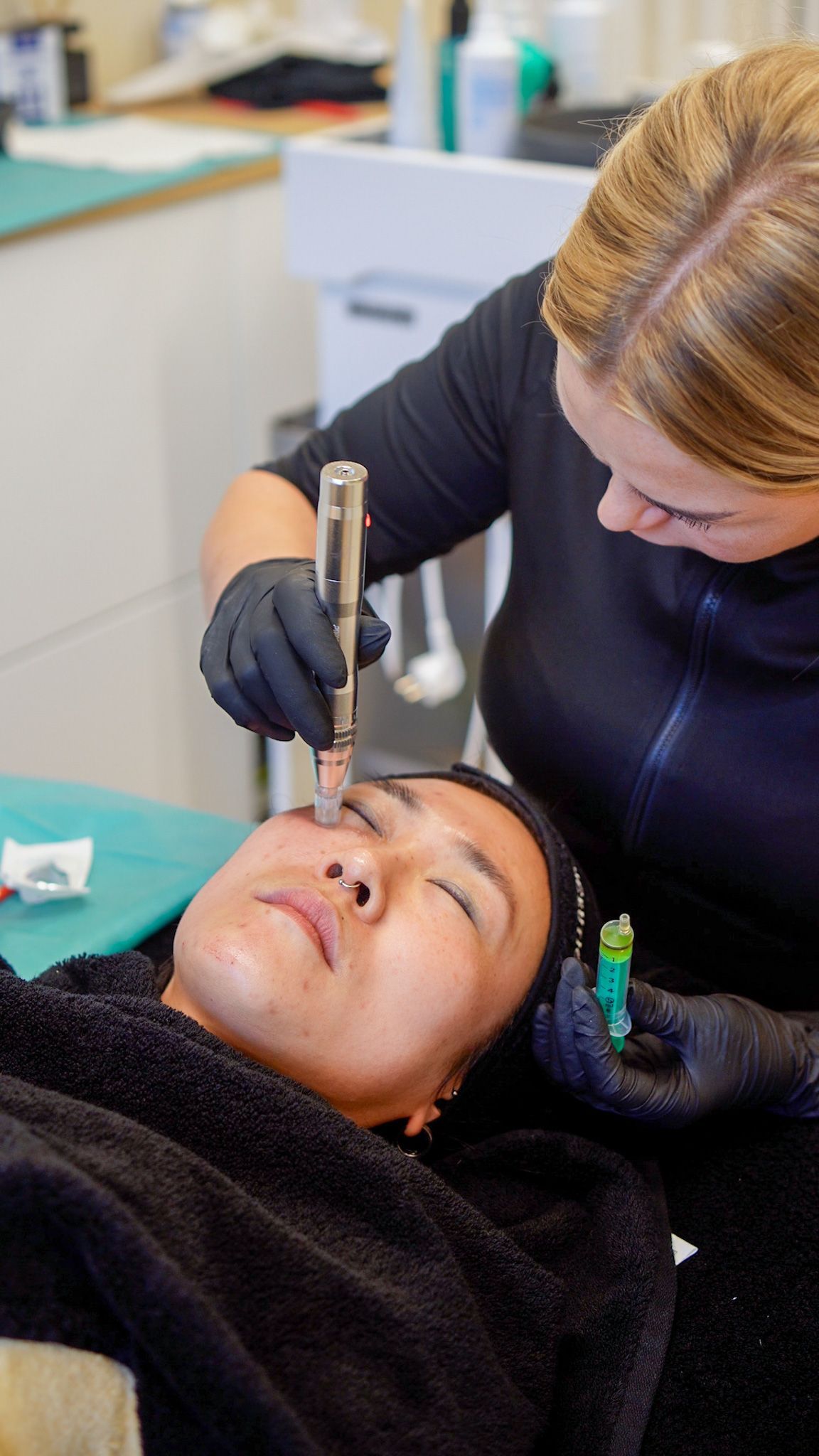 Kundin während einer Microneedling-Behandlung – feine Nadeln stimulieren die Kollagenproduktion für eine glattere und straffere Haut.